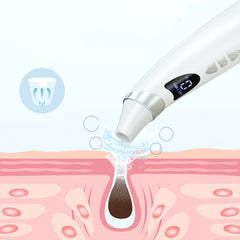 Electric Blackhead Removal Tool
