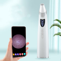 Electric Blackhead Removal Tool